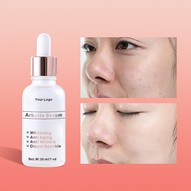 Wholesale 2% Alpha Arbutin Serum Skin Lightening Removing Pigmentation Acne Marks Dark Spots Face Serum