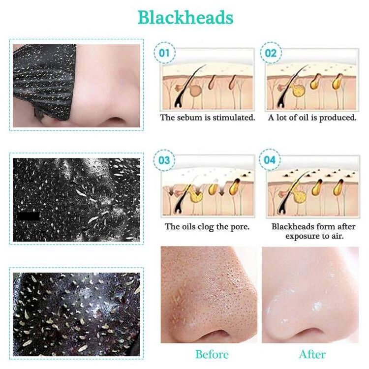 Blackhead Remover Oil Control Deep Cleansing Charcoal Strips Black Head Nose Strips