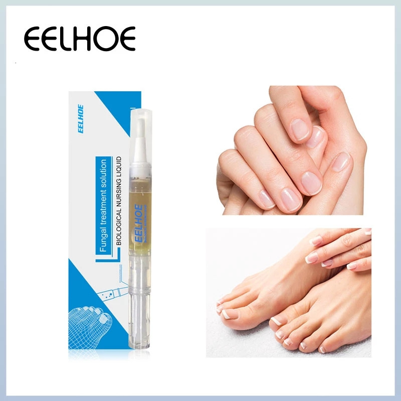 Anti Fungal Treatment Nail Pen Onychomycosis Paronychia Infection Herbal Toe Finger Repair Hand Foot Skin Care