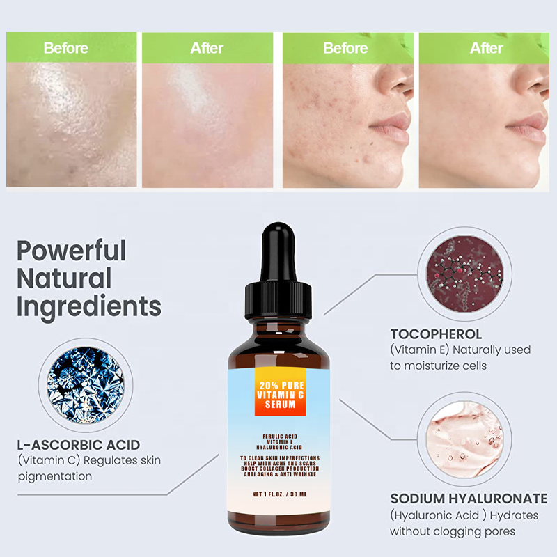 Vegan Moisturizing Anti Aging Wrinkles Whitening 20% Vitamin C Serum With Ferulic Acid Vitamin E Hyaluronic Acid For Acne Scars