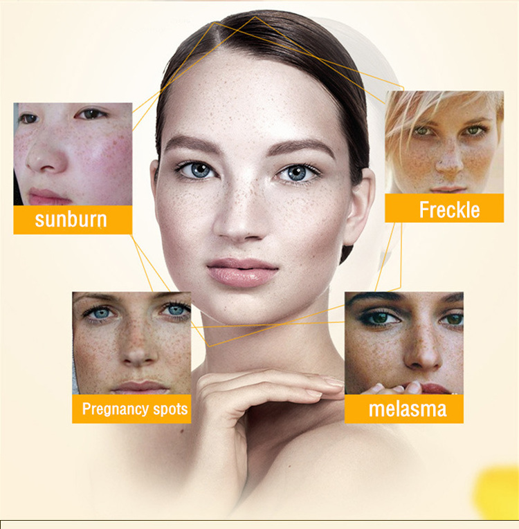 SNMLPM Skin Whitening Dark Spots Face Cream Freckle Facial Cream Freckle Lightening Cream