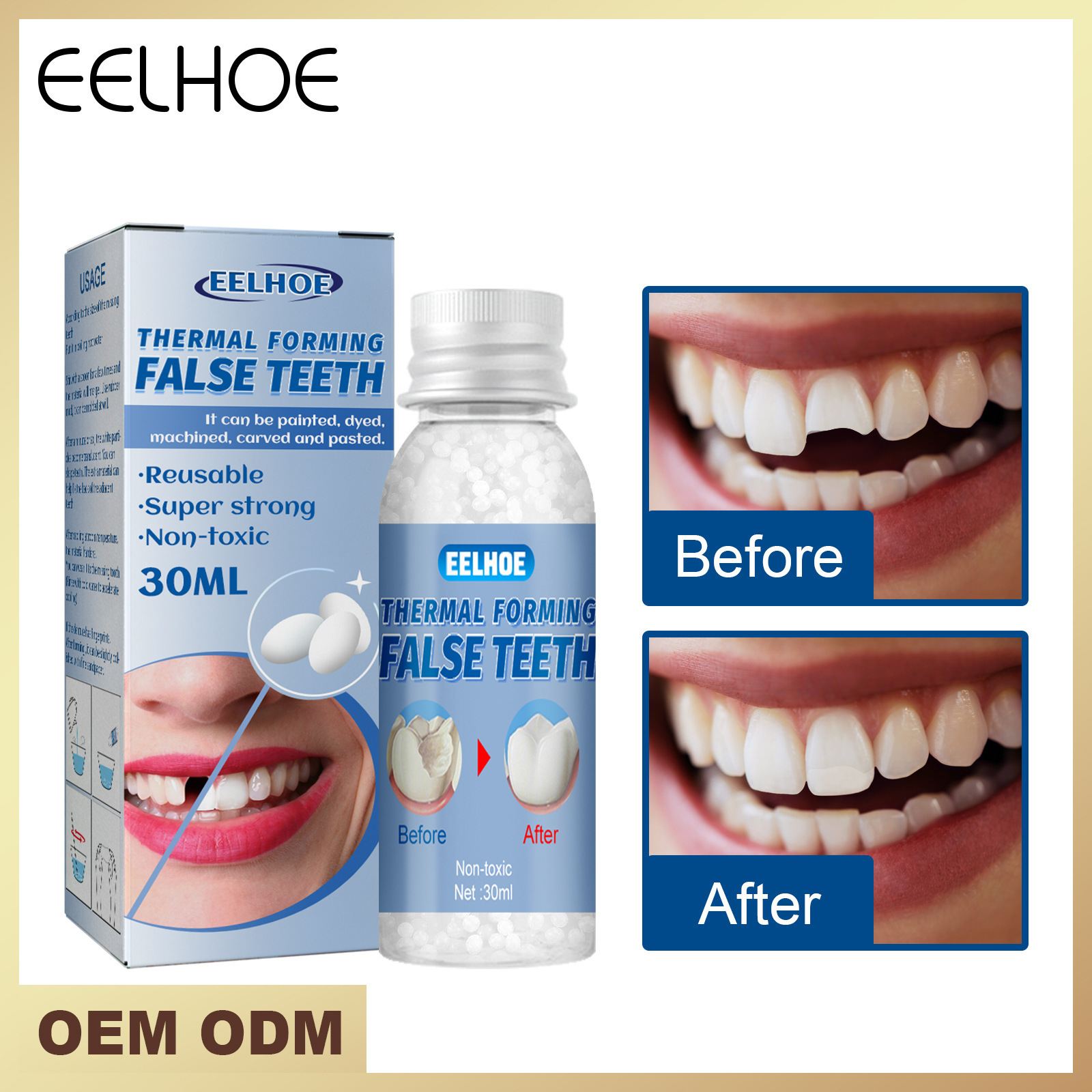 EELHOE Dental Glue Teeth Repair Reusable Moldable Temporary False Teeth Solid Glue 30ml