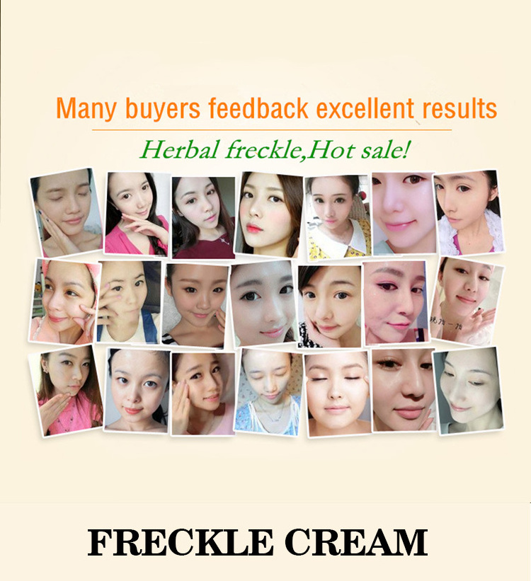 SNMLPM Skin Whitening Dark Spots Face Cream Freckle Facial Cream Freckle Lightening Cream