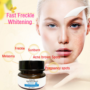 SNMLPM Skin Whitening Dark Spots Face Cream Freckle Facial Cream Freckle Lightening Cream