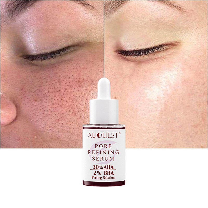 AUQUEST Pore Refining Skin Serum Shrinking Pores AHA Facial Nose Pore Serum 40ml