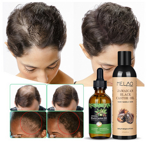 Wholesale Jamaican Black Castor Oil For Hair Growth Skin Moisture Oil Organic Cold Pressed Castor Oil Huile De Ricin Hair Growth