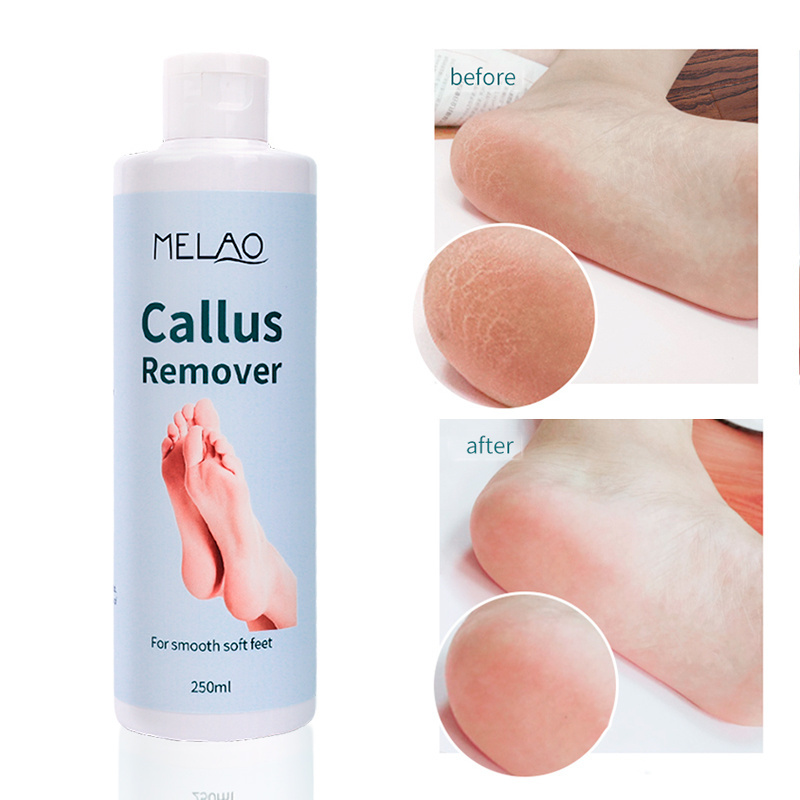 MELAO Cracked Heel Repair Tough Callus Remover Gel Callus Remover For Feet