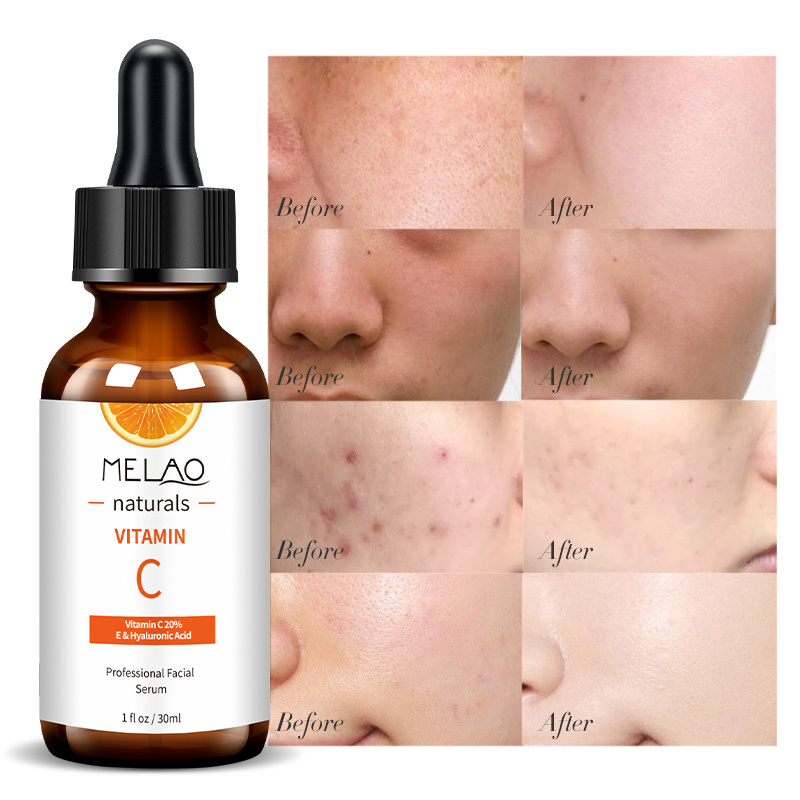 New Vitamin C Serum 20% E With Hyaluronic Acid For Face Powerful Anti Ageing & Anti Wrinkle Face Serum