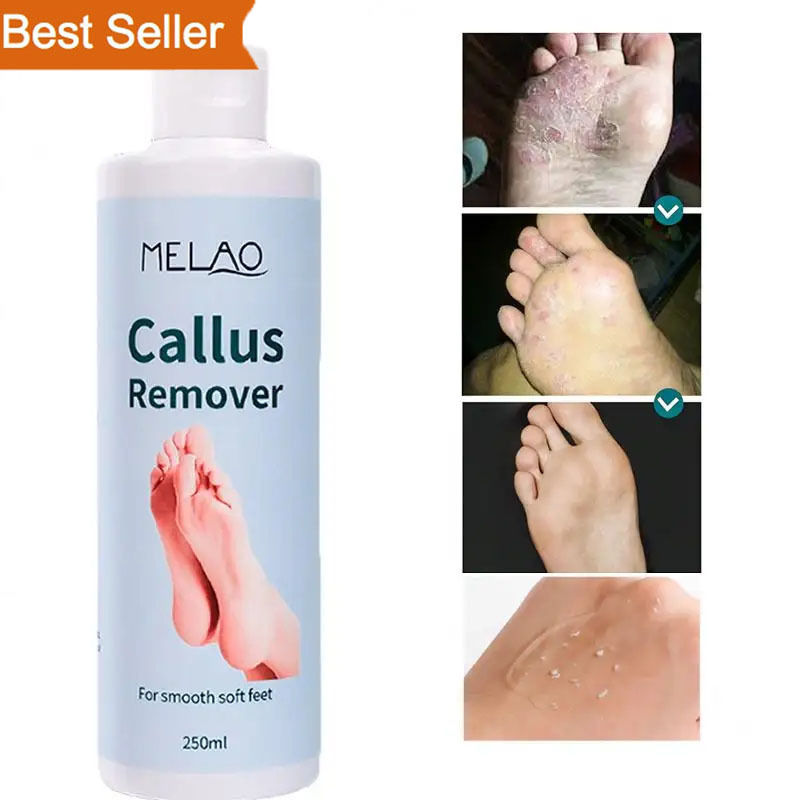 Professional Foot Callus Removal Gel Private Label Callus Remover Foot Gel For Dry Cracked Feet