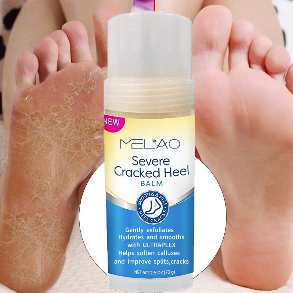 MELAO Foot Skin Care Lavender Foot Cream Foot Repair Balm Stick Skin Moisturizer For Dry Cracked Feet Hands Heels Elbows Kness