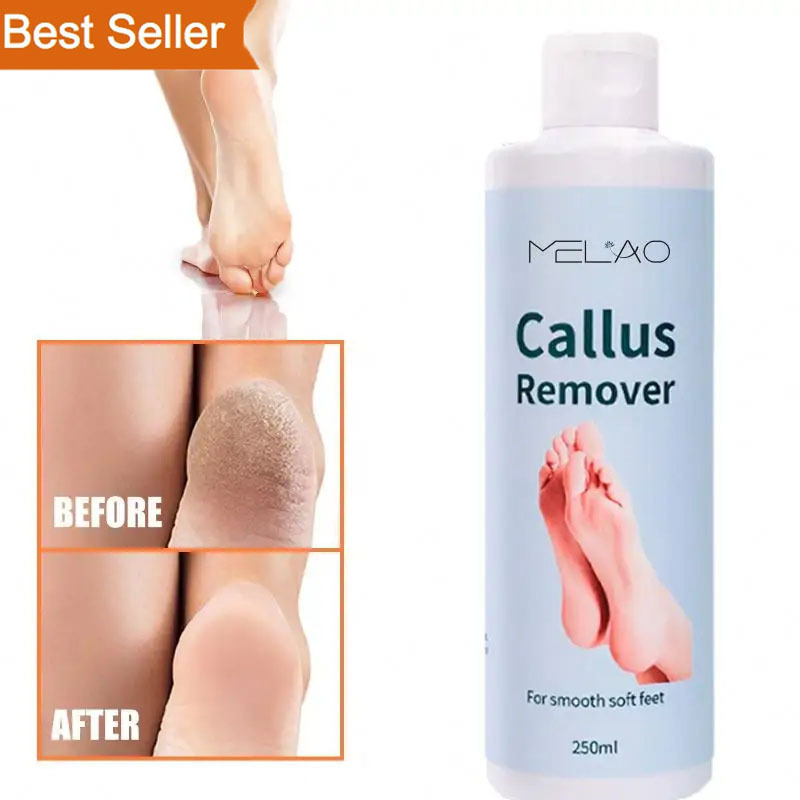 Professional Foot Callus Removal Gel Private Label Callus Remover Foot Gel For Dry Cracked Feet