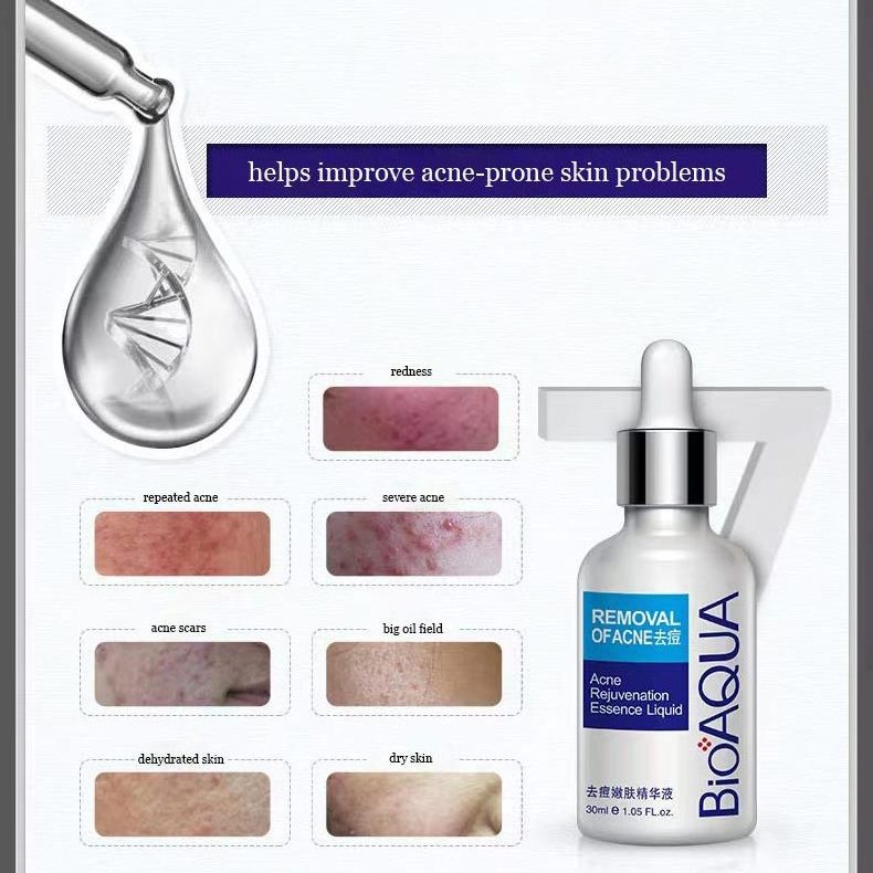 bioaqua removal Acne essence liquid Private Label acne rejuvenation essence liquid Face Skin Care Lifting Serum For Face Organic