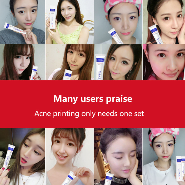 Face anti acne Treatment pimples gel cream Repairing Hydrating Gel Mild Soothing Nourish Skin Scar Therapy Gel 15 gram