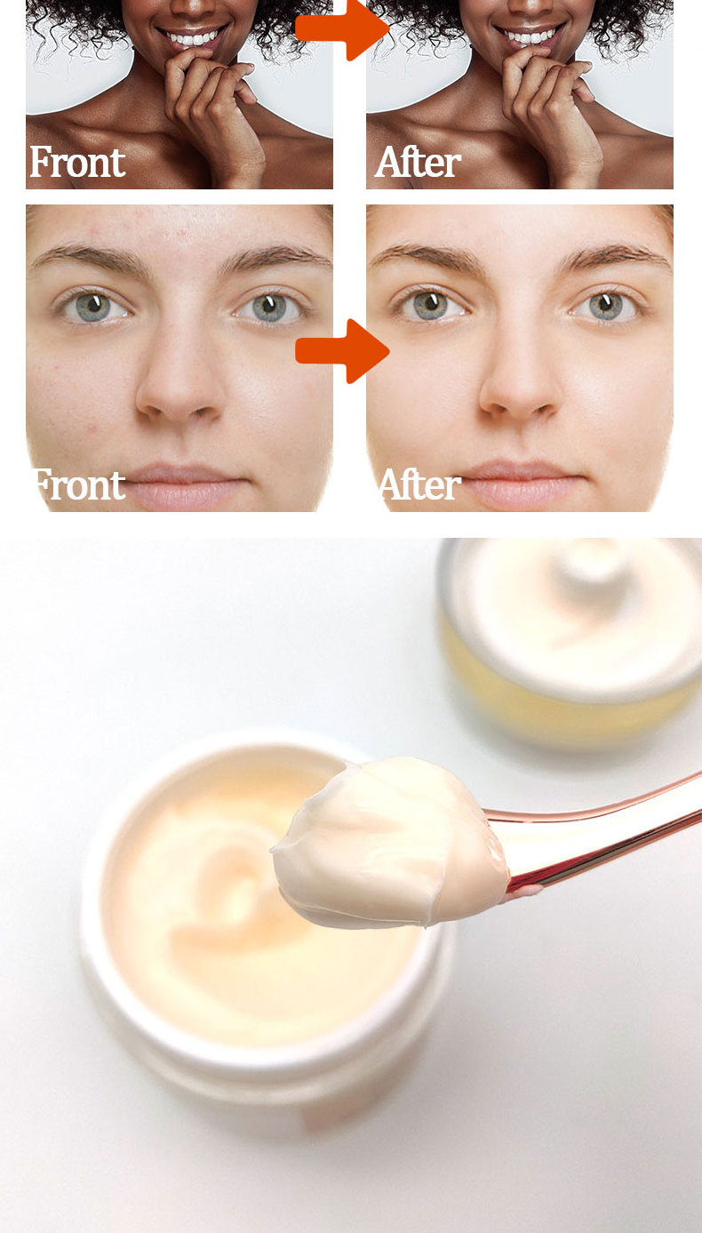 OEM Carotone Cream Whitening Organic Face Cream  Anti Aging Wrinkle  Moisturizing Face And Body Whitening Cream