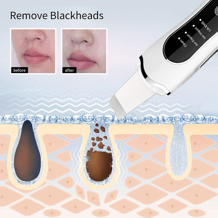 High Quality Ems Vibration Face Spatula Peel Facial Peeling Skin Care Cleaner Sonic Spatula Ultrasonic Skin Scrubber