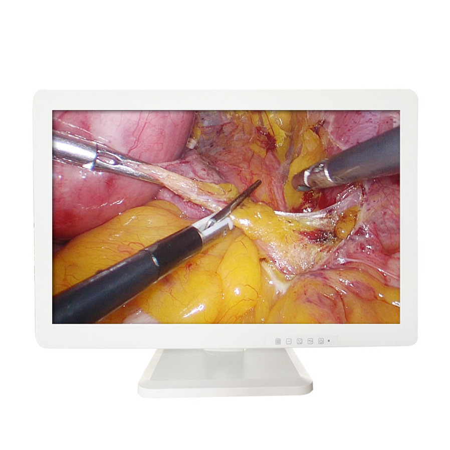 Highest Cost-effective Medical Endoscopic HD LCD Monitor 43 Inch Medical Grade Lcd Monitor