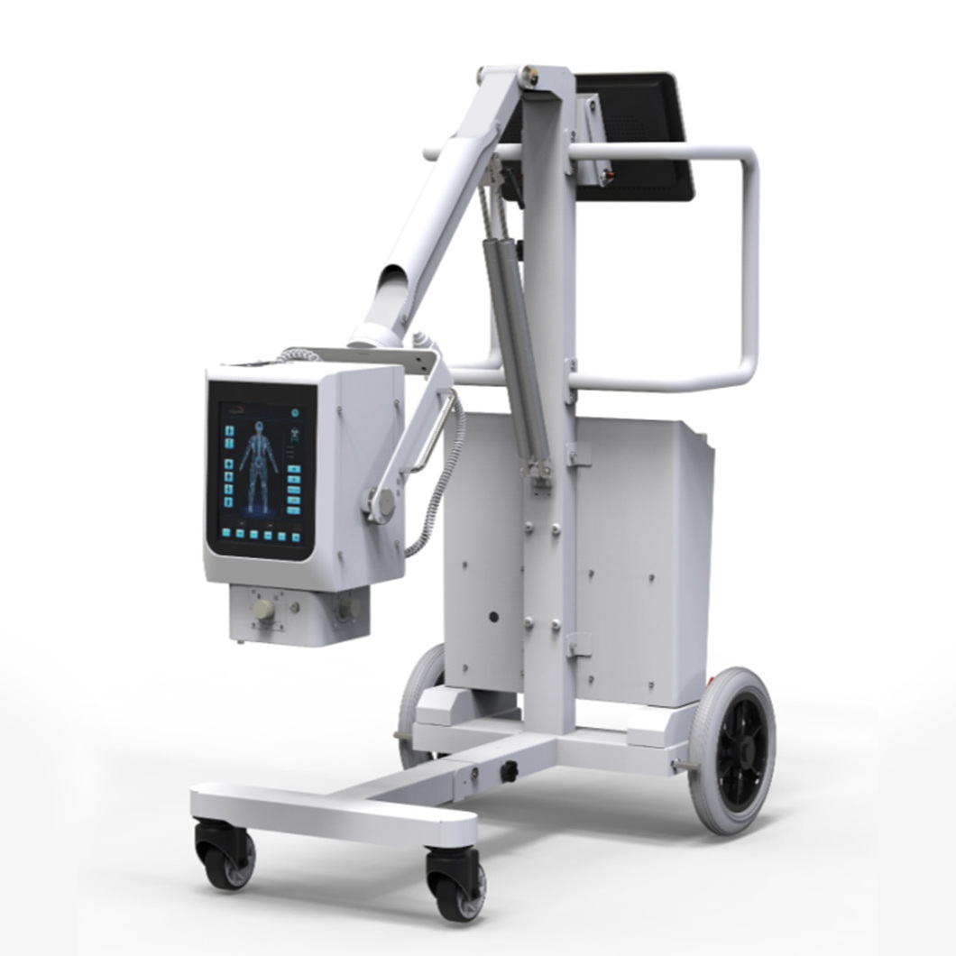 Super High Quality Portable 10.4 Inch Touch Screen Multi-language X-ray Machine for Clinical Diagnosis