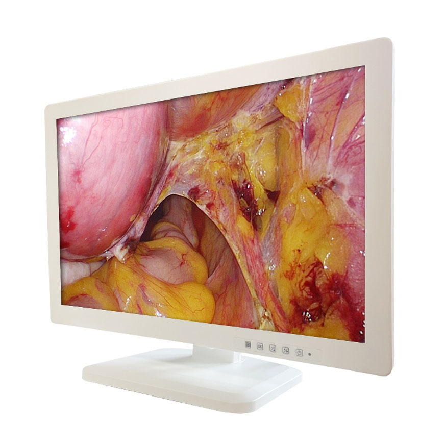 Highest Cost-effective Medical Endoscopic HD LCD Monitor 43 Inch Medical Grade Lcd Monitor