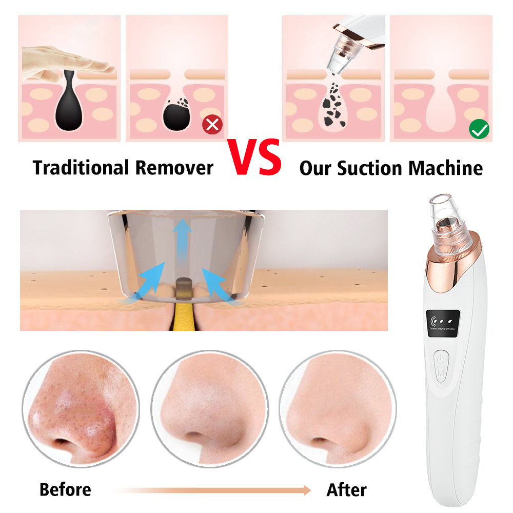 Hailicare Face Skin Care Tool Acne Pimple Black Head Extractor Electric Vacuum Suction Blackhead Remover