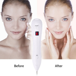 Fibroblast Scars Laser Skin Tag Beauty Professional Sweep Spot Plasma Mole Removal Pen