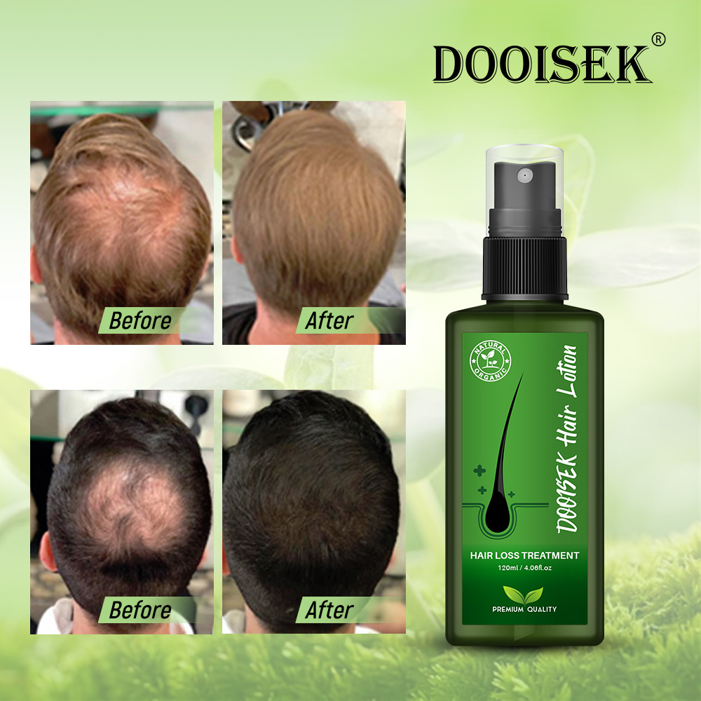 Popular Products Scalp Treatment Anti Hair Loss regrowth hair serum oil new dooisek hair lotion Thailand With Brand new