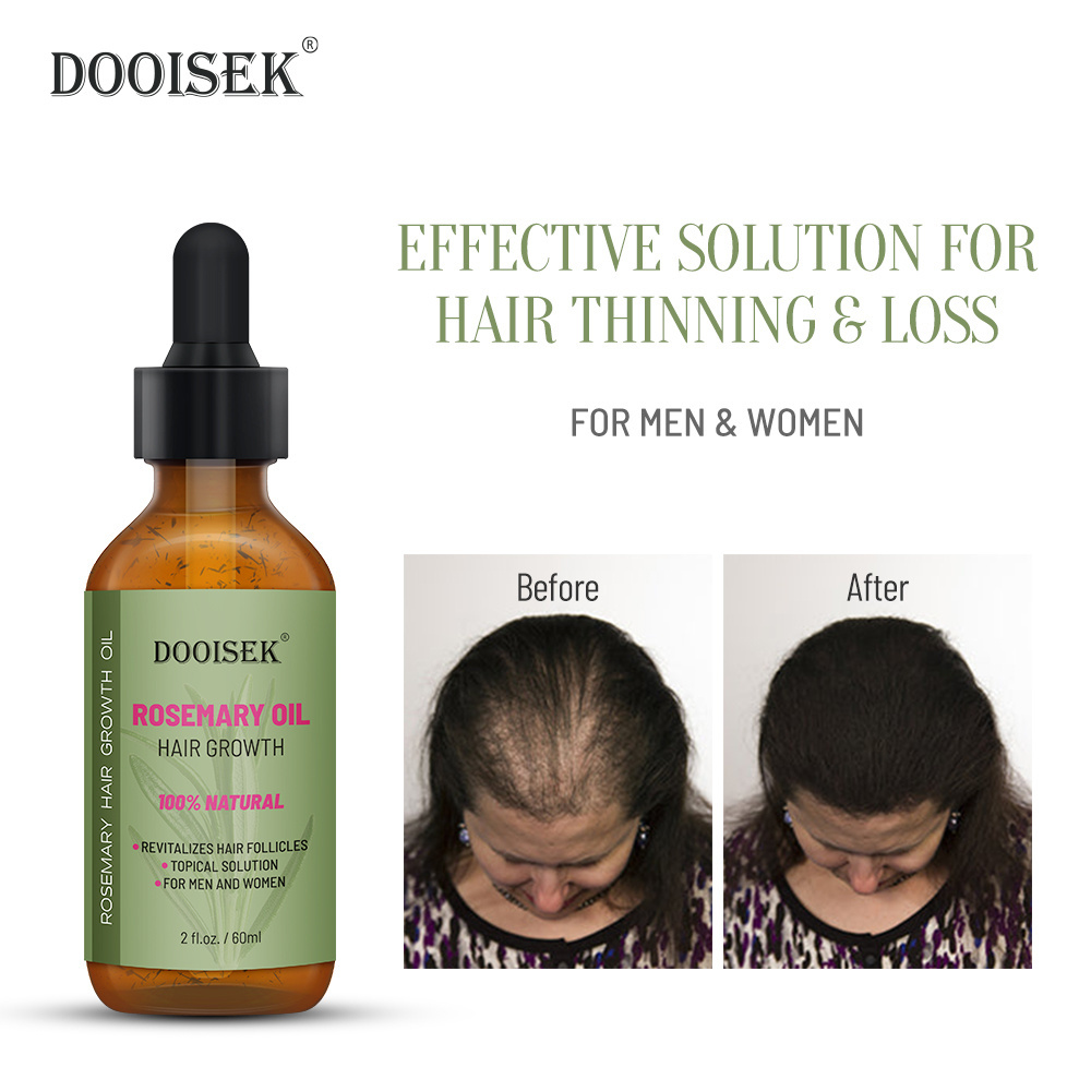 100% Natural Organic Nourishing Promote Serum Hair Growth Rosemary Essential Oil Hair Regrowth Treatment