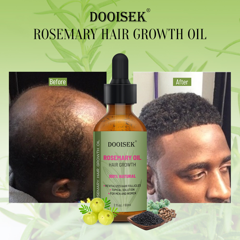 100% Natural Organic Nourishing Promote Serum Hair Growth Rosemary Essential Oil Hair Regrowth Treatment