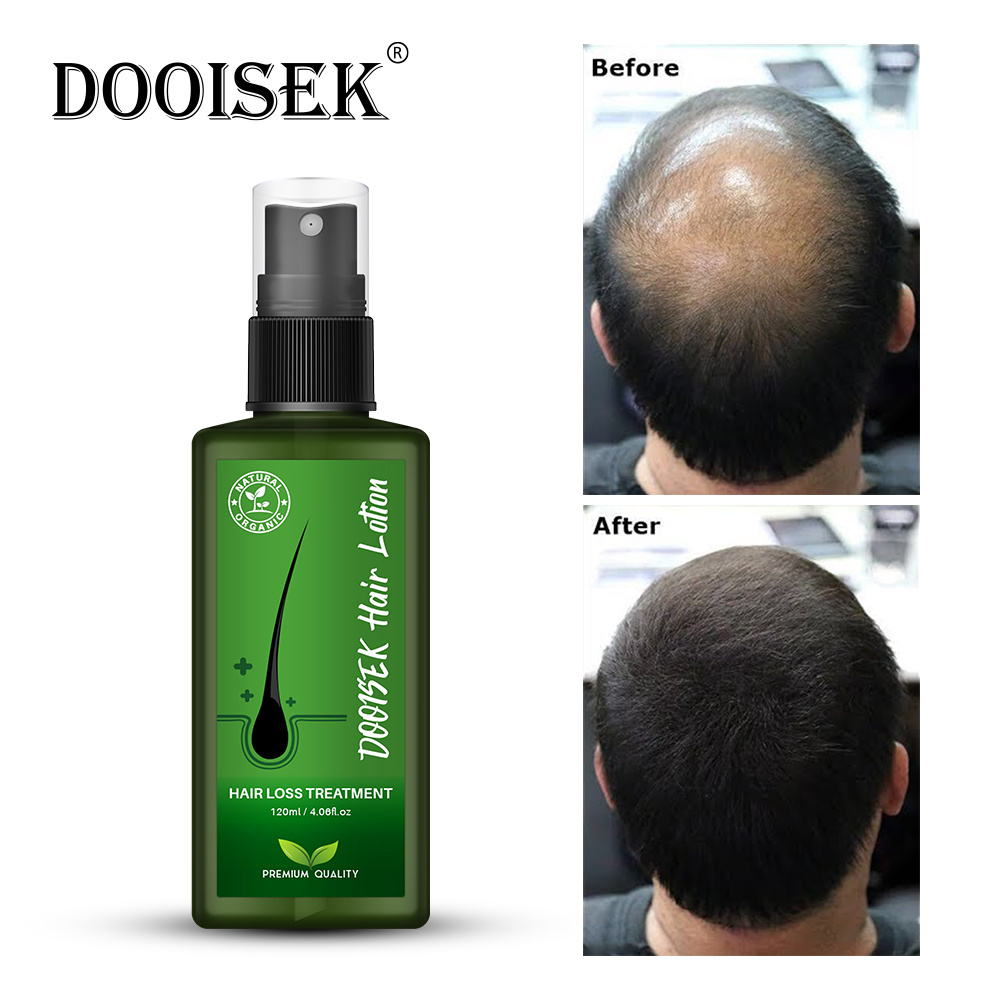 Popular Products Scalp Treatment Anti Hair Loss regrowth hair serum oil new dooisek hair lotion Thailand With Brand new