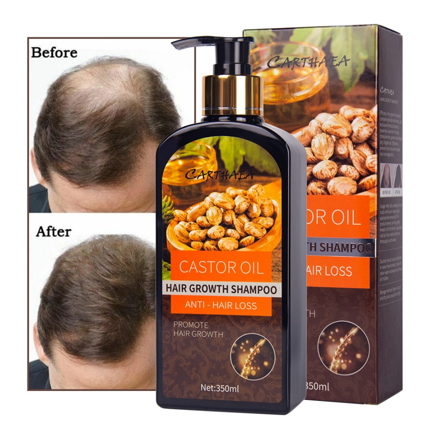 wholesale private label castor oil hair shampoo products hair growth products for men