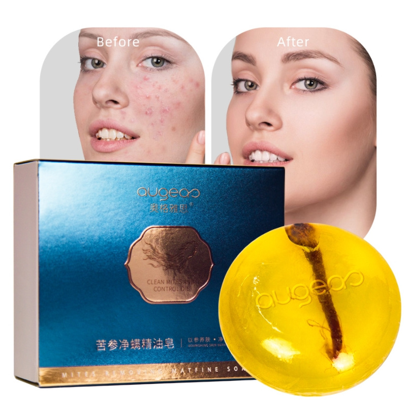 whitening anti acne soap for face