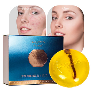 whitening anti acne soap for face