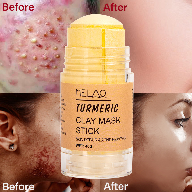 Private Label Acne Pimple Remover Whitening Mud Mask Brightening Organic Detox Turmeric Face Clay Mask Turmeric Mask Stick