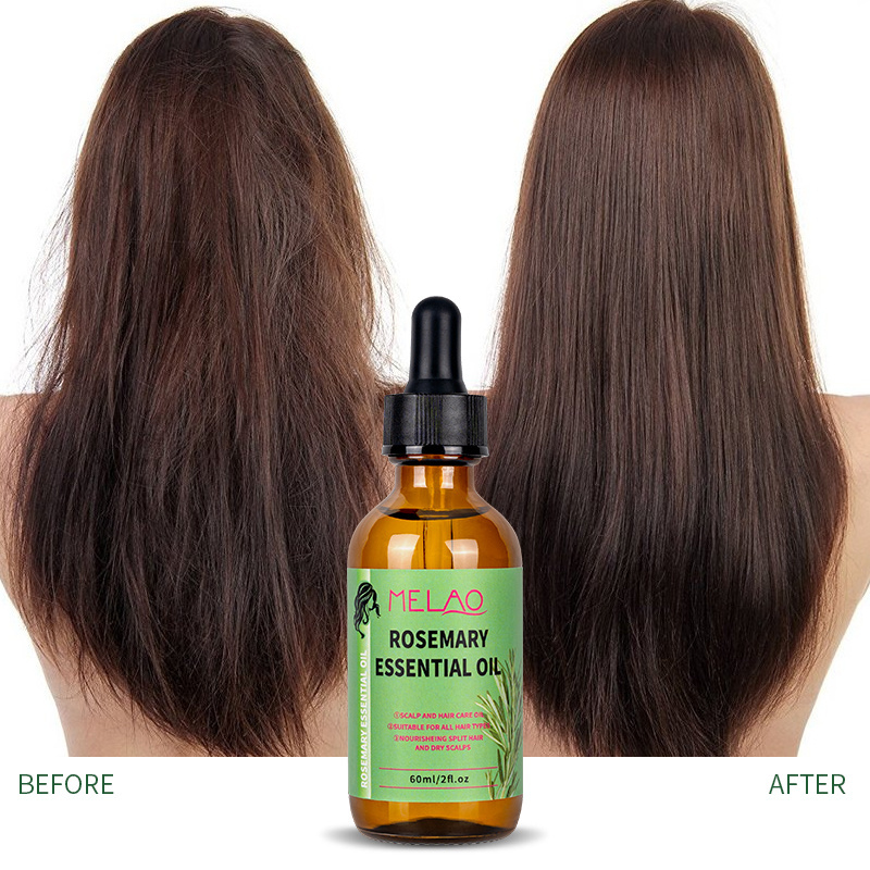 Natural Organic Rosemary Mint Essential Oil Hair Strengthening Nourish Sooth Dry Scalp Private Label Hair Growth Hair Care Oil