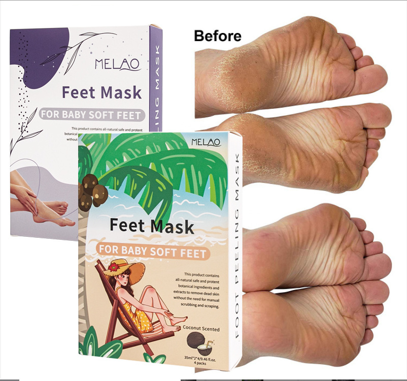 MELAO 4 Pair OEM Wholesale Feet Skin Care Peel Off Mask Moisturizing Exfoliating Footmask Natural Organic Foot Peeling Masks