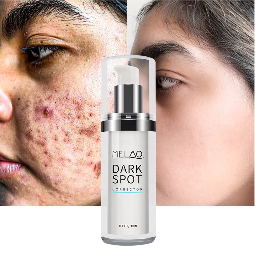 Private Label Natural Collagen Dark Spot Corrector Remover Brightening Anti Aging Face Serum For Sensitive Skin