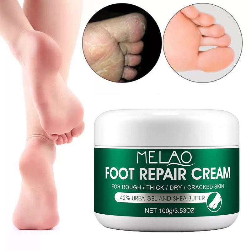 Wholesale MELAO Repairing Foot Cream Dry Skin Moisturize Feet Softening Herbal Callus Customize For Antifungal Foot Skin Care