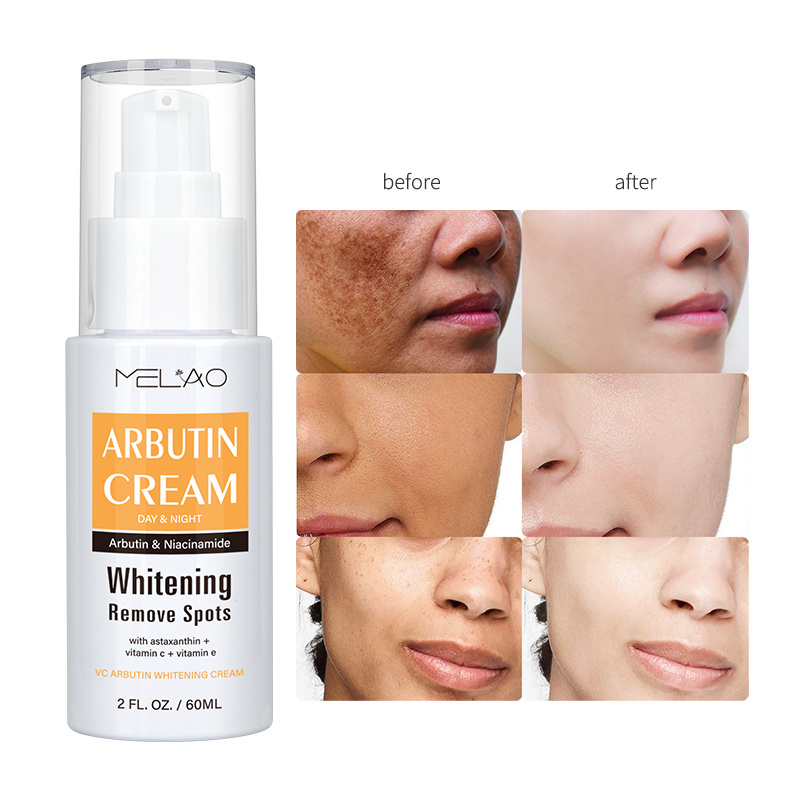 Wholesale Face Cream Imminent Wrinkle Remover Face Cream Firming Lifting Dark Spot Remover Best Cream For Dark Spot Removal