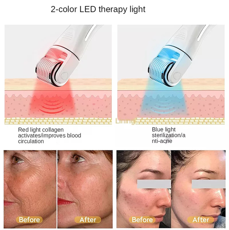 Red/blue led therapy light derma roller electric microneedle derma roller wireless derma roller for hair regrowth