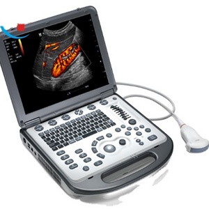 Medical Equipment USG Mindray M6 Color Portable Ultrasound Machine Ultrasound Machine Portable