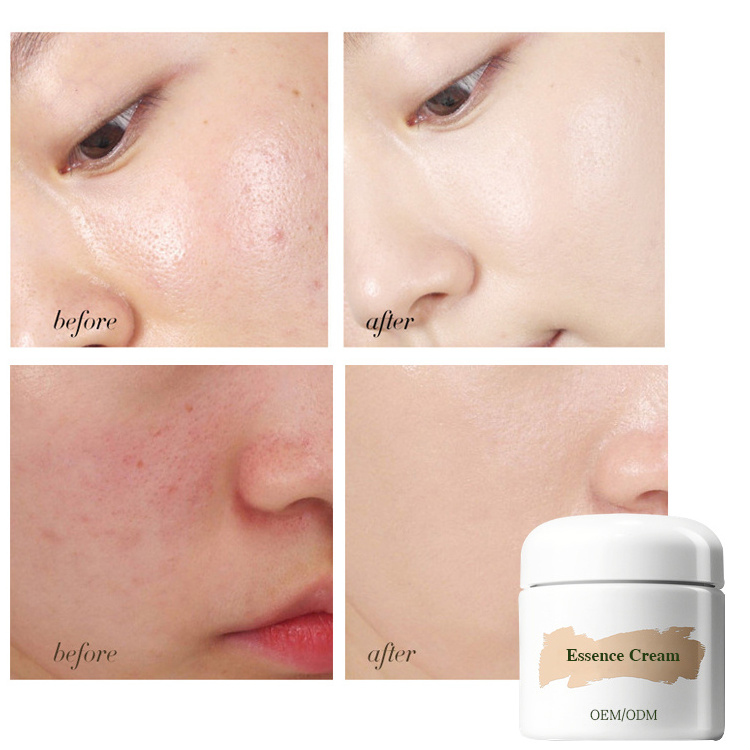 Private Label Rejuvenation Essence Cream Nourishing Moisturizing Cream Miracle Broth Anti Aging Repair Face Cream