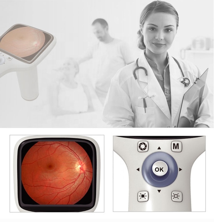 fundus camera FC-100