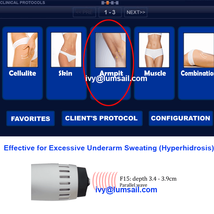 Extracorporeal Shockwave Therapy Device for Excessive Underarm Sweating (Hyperhidrosis)