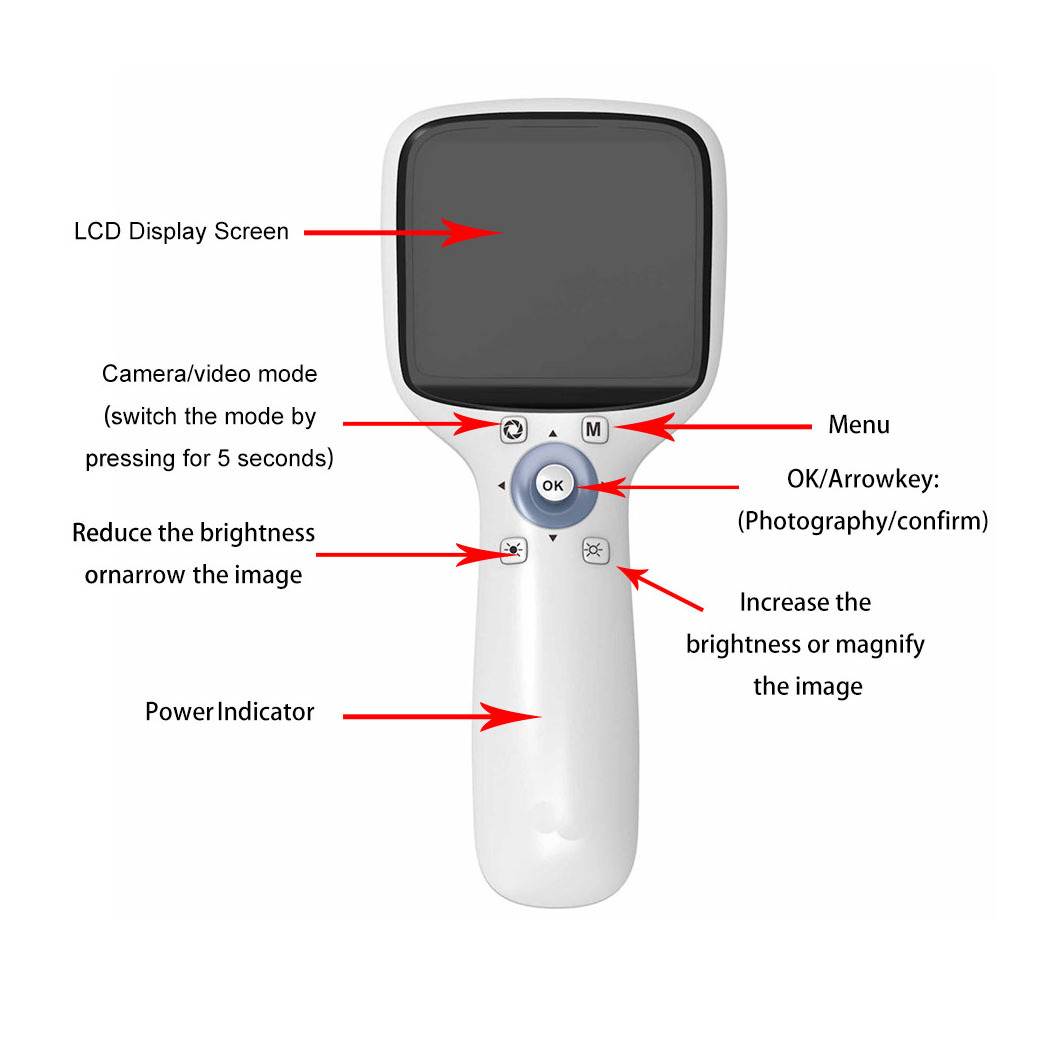 Medical Ophthalmic Equipment Handheld Portable Eye Examination Retinal Non-mydriatic Digital Fundus Camera