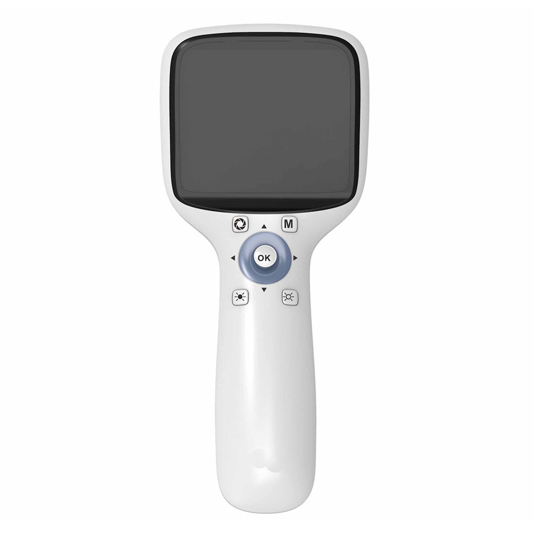 New Arrival Ophthalmic Equipment Factory Best Price Handheld Non Midiatric Fundus Retinal Camera