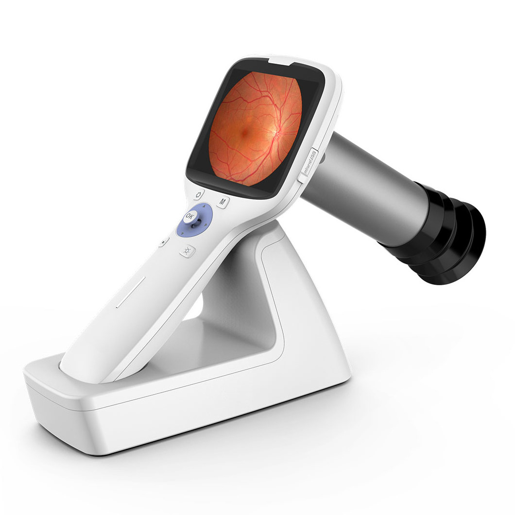 New Arrival Ophthalmic Equipment Factory Best Price Handheld Non Midiatric Fundus Retinal Camera