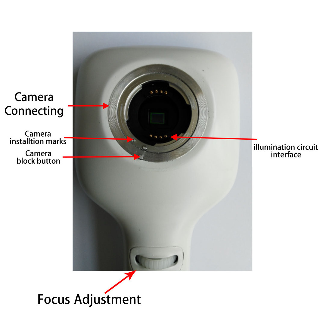 Medical Ophthalmic Equipment Handheld Portable Eye Examination Retinal Non-mydriatic Digital Fundus Camera