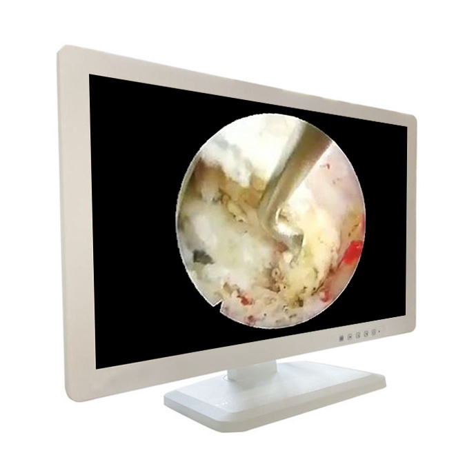 Medical LCD Image Display Screen 1080P 24 Inch HD Surgical Monitor for Laparoscopy Surgical