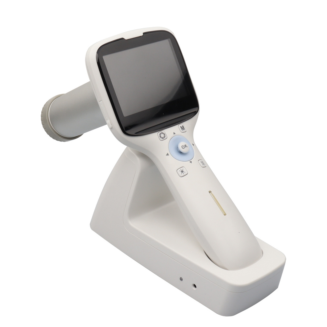 Medical Ophthalmic Equipment Handheld Portable Eye Examination Retinal Non-mydriatic Digital Fundus Camera