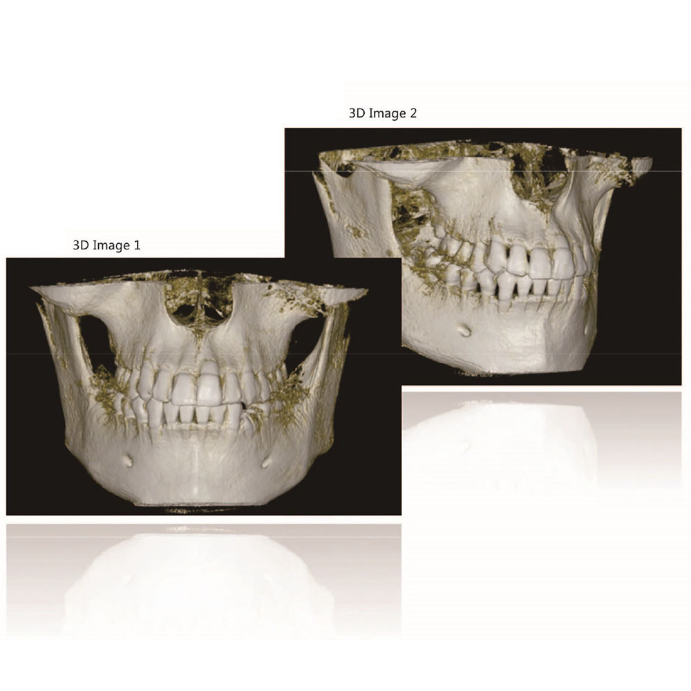 Medical Equipment 2D 3D Dental Panoramic and Cephalometric X ray Machine CBCT Digital X-ray for Sale