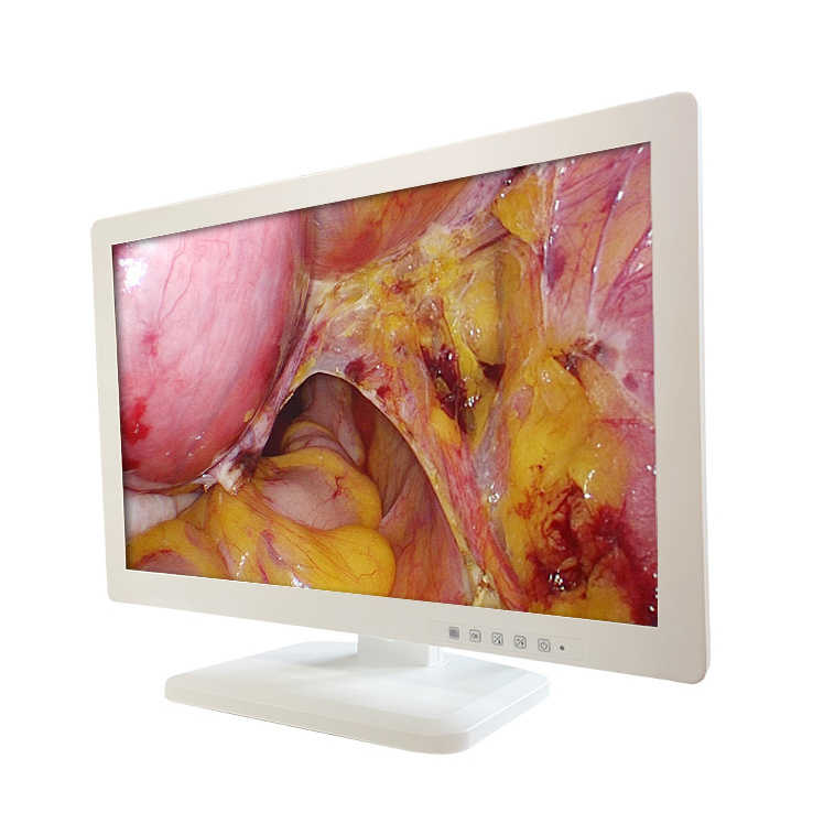 Medical LCD Image Display Screen 1080P 24 Inch HD Surgical Monitor for Laparoscopy Surgical